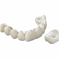 lucrari dentare iasi